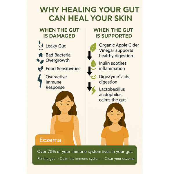 Gut Harmony Eczema Relief